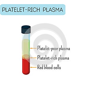Platelet rich plasma in a glass test tube infographics. Blood composition. photo