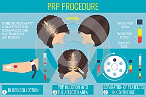 Platelet rich plasma procedure for a woman