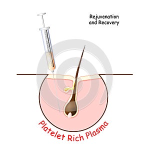 Platelet rich plasma for Rejuvenation and Recovery skin and hair. PRP treatment photo