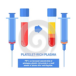 Platelet rich plasma therapy procedure infographics poster photo