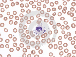 Platelet satellitism photo
