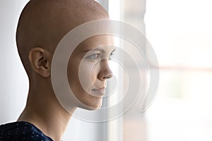Pleasant young hairless woman looking at window.