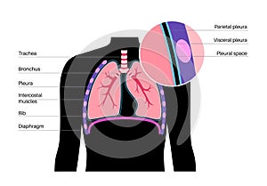 Pleura anatomical poster