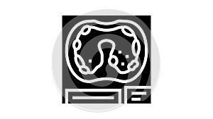 pleural asbestosis disease glyph icon animation