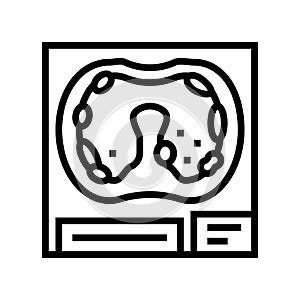 pleural asbestosis disease line icon vector illustration