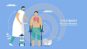 Pleural effusion is collection of excess fluid between layers of pleura outside lungs. Pulmonology vector illustration about