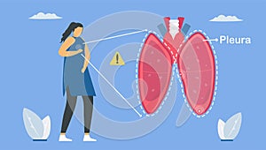 Pleurisy is pleura that separate lungs from chest wall. And it becomes inflamed. Pulmonology vector illustration about restrictive