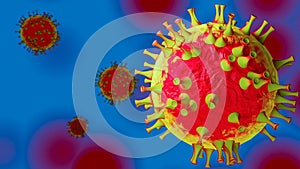 Pneumonia due to new coronavirus Covid 19 infection in China