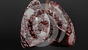 Pneumonia illness, healthy lungs and disease lungs, Human Lungs cancer, Cigarette smokers Lung disease, asthma infection