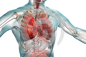 Pneumonia medical concept