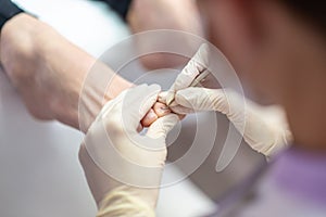 Podiatrist removing cuticle from a toenail photo