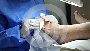 Podiatrist in white gloves clean with cotton a toenail. Concept of podology and chiropody.