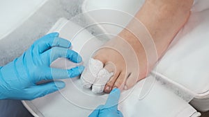 Podologist uses a bandage after applying antiseptic to the toe after removing the nail