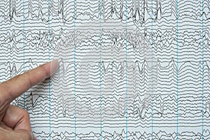 Pointing at imaging of human electroencephalography recording