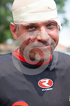 POINTNOIRE/CONGO - 18MAY2013 - Expressive portrait of injured rugby player