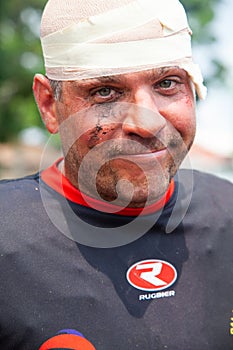 POINTNOIRE/CONGO - 18MAY2013 - Expressive portrait of injured rugby player