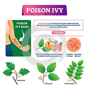 Poison ivy vector illustration. Educational dangerous urushoil plant scheme