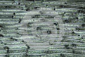 Polarizing micrograph of leaf cells from Grimmia moss from Connecticut.