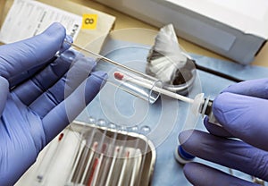 Police expert checks samples chemical as fundamental test in a murder case in crime lab