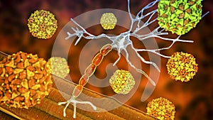 Polio viruses affecting motor neurons