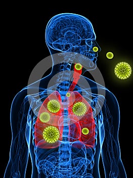 Pollen allergy illustration