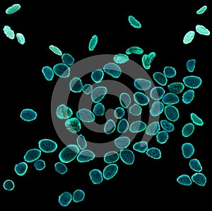 Magnified pollen grains under the light microscope, black background photo