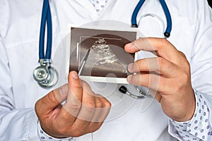 Polycystic kidney disease on ultrasound image concept photo. Doctor indicating by pointer on printed picture of ultrasound patholo