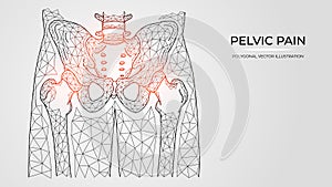 Polygonal vector illustration of pain, inflammation or injury in the pelvis and hip joint