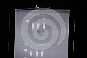 Polymerase Chain Reaction PCR and Agarose gel electrophoresis is a method of gel electrophoresis.