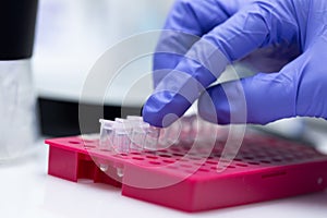 Polymerase Chain Reaction PCR and Agarose gel electrophoresis is a method of gel electrophoresis.