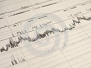 Polysomnography PSG sleep study