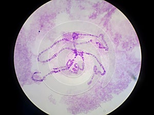 Polytene chromosomes Giant chromosomes