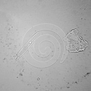 Pond water plankton and algae at the microscope. Diatoms