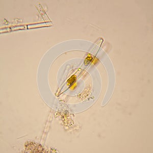 Pond water plankton and algae at the microscope. Diatoms