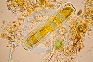 Pond water plankton and algae at the microscope. Diatoms