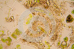 Pond water plankton and algae at the microscope. Diatoms