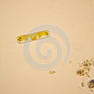 Pond water plankton and algae at the microscope. Diatoms photo