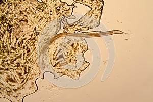 Pond water plankton and algae at the microscope. Nematode