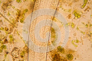 Pond water plankton and algae at the microscope. Nematode