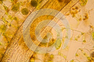 Pond water plankton and algae at the microscope. Nematode