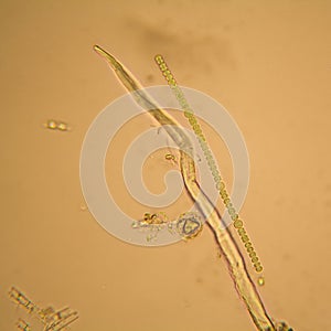Pond water plankton and algae at the microscope. Nostoc commune