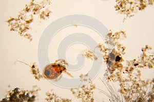 Pond water plankton and algae at the microscope. Pond mite