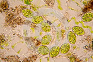 Pond water plankton and algae at the microscope. Spirogyra