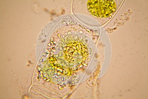 Pond water plankton and algae at the microscope. Spirogyra