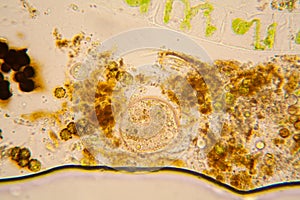 Pond water plankton and algae at the microscope. Spirogyra