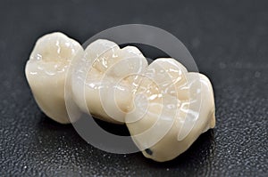 Porcelain dental crown