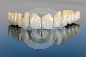 Porcelain teeth - dental bridge