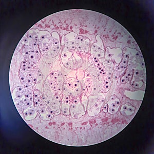 Pork tapeworm Taenia solium, section through the body