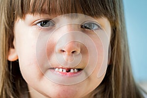 Portrait of adorable kid missing her first milk tooth.  Lifetime moments and happy childhood concept. Close up