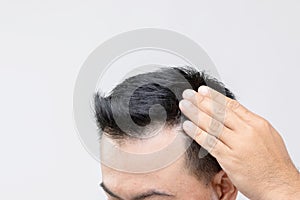 Portrait Asian man with worry feeling and touching on his head to show bald head or Glabrous problem. Studio shoot with copy space